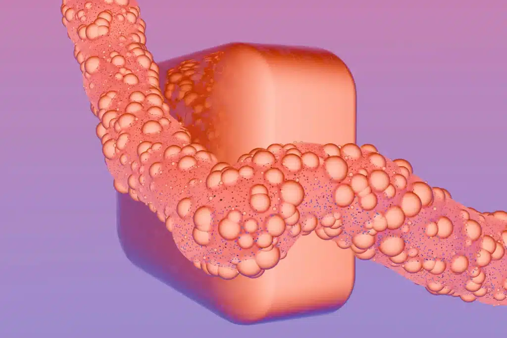 Is Crohn’s Disease Fatal? 3D medical illustration showing intestinal inflammation and digestive tract complications.