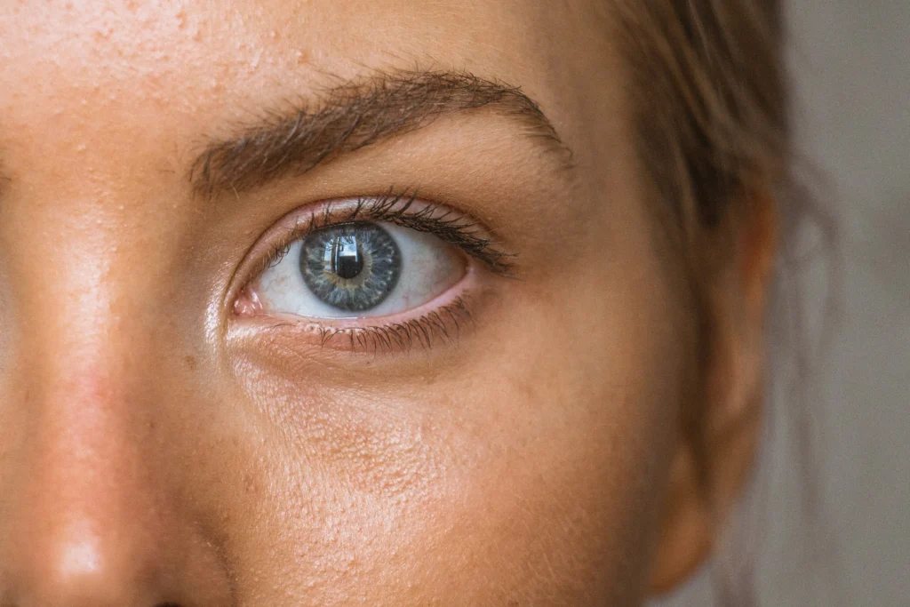 Close-up of a person’s eye illustrating mental health awareness and the question, Is OCD an Anxiety Disorder.
